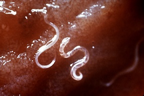 Canine Hookworms